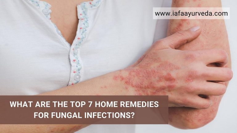 What are the Top 7 Home Remedies for Fungal Infections?